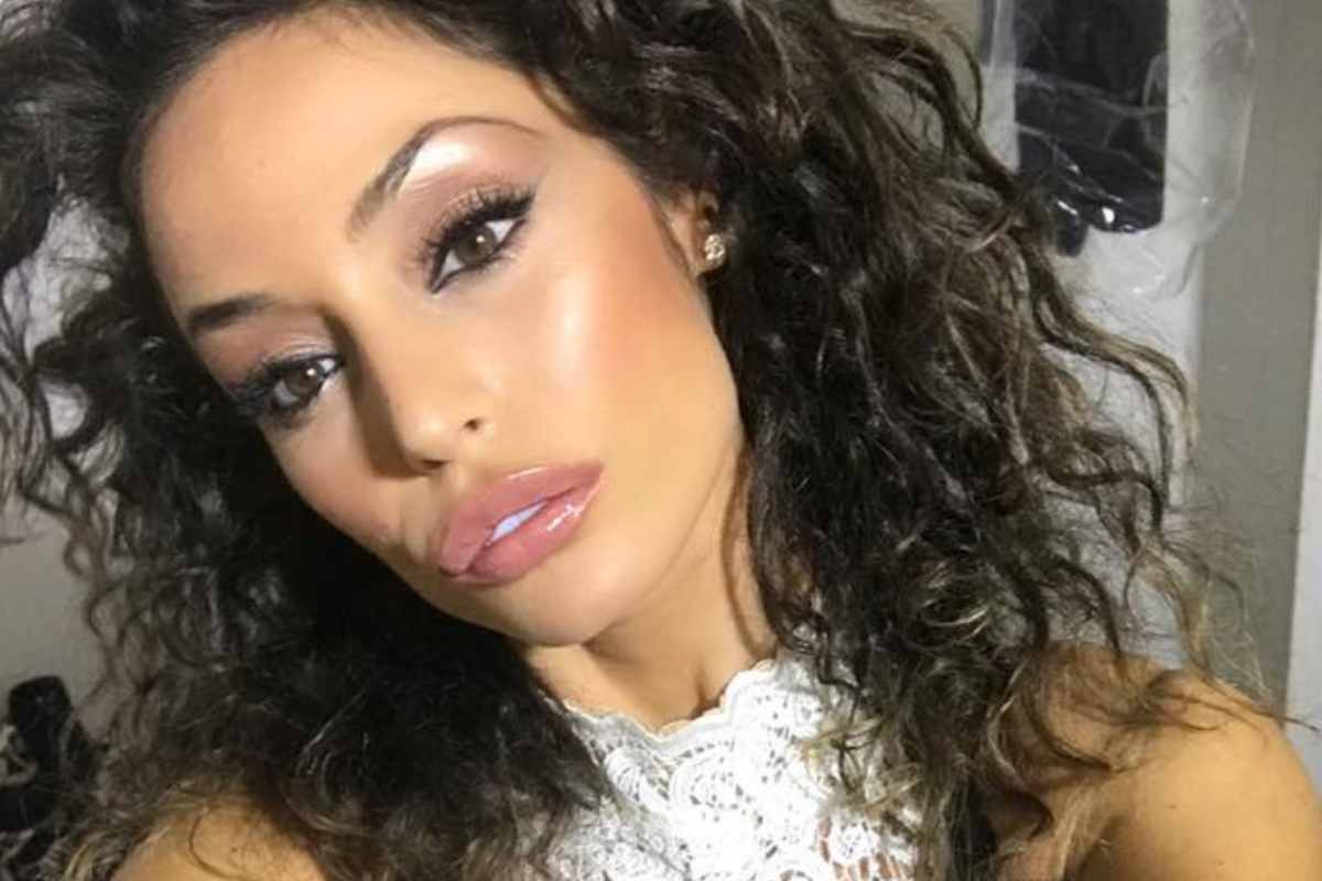 Raffaella Fico, la verità sulle labbra “lievitate”